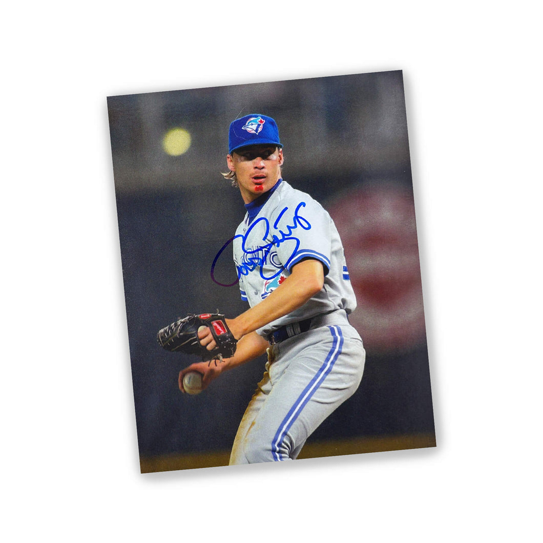 Todd Stottlemyre Autographed Print - Blue Jays Bloody Chin